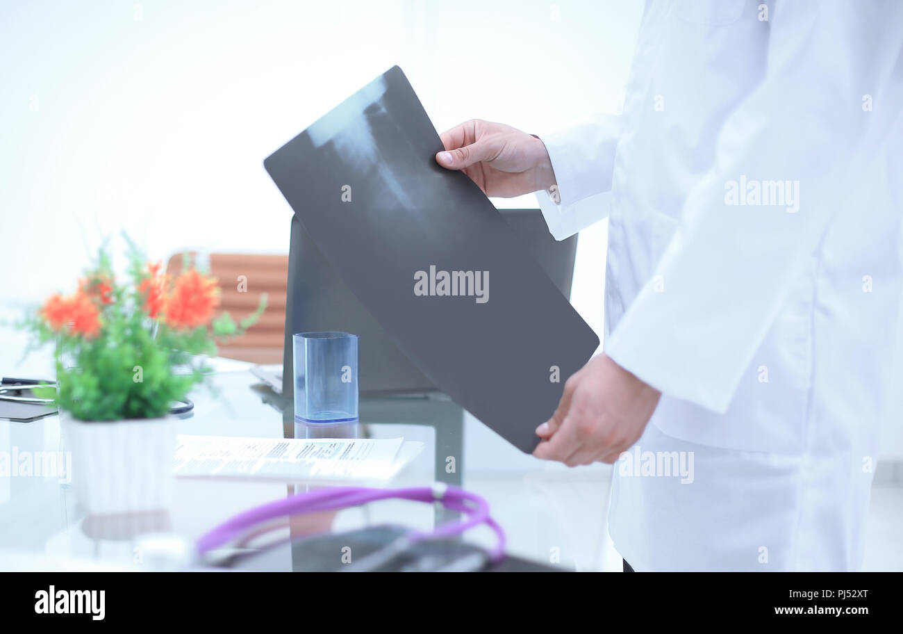 Bis zu schließen. x-ray Bild des Patienten in den Händen des Arztes Stockfoto