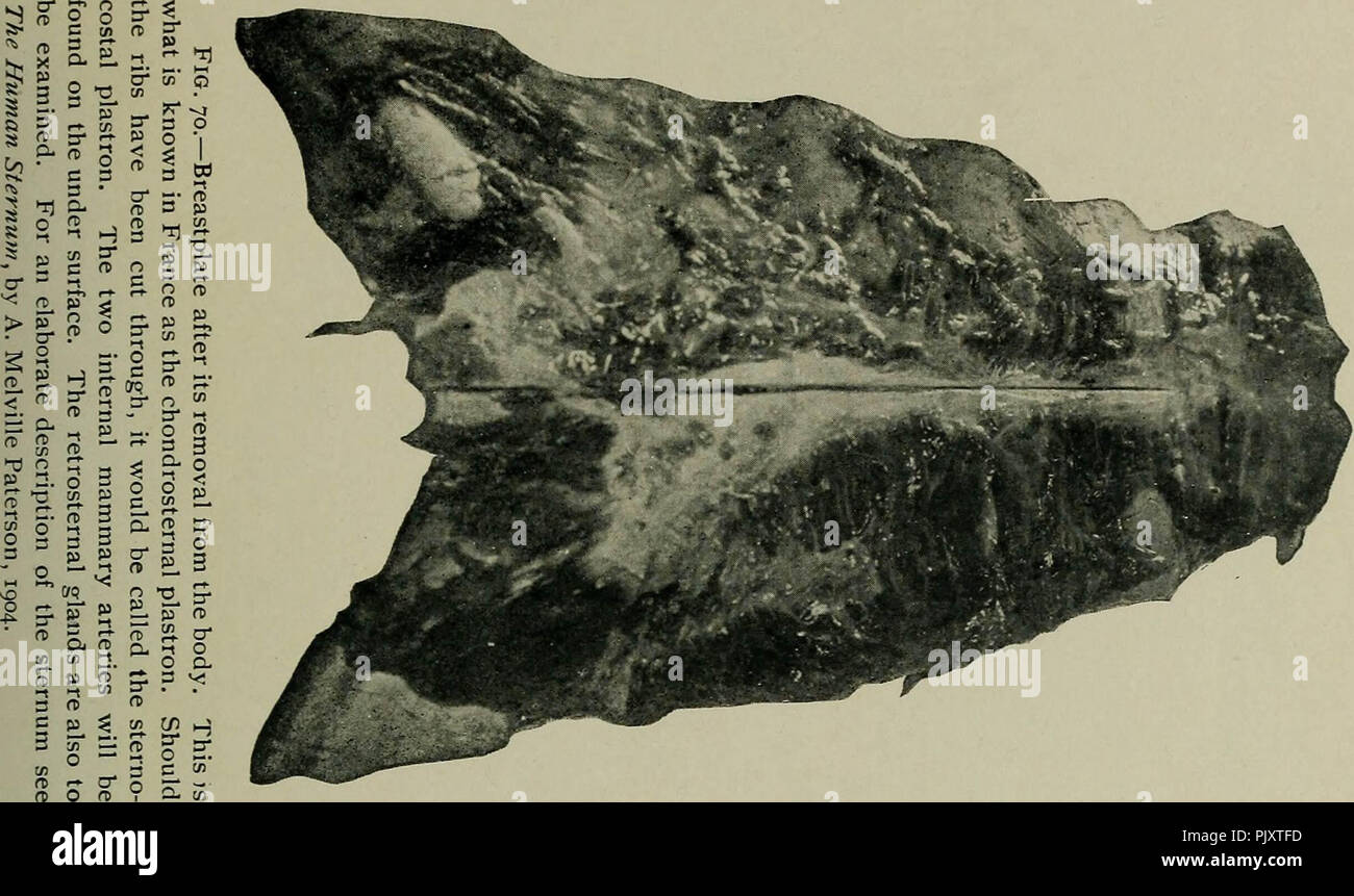Postmortem pathology manual technic post mortem Fotos und