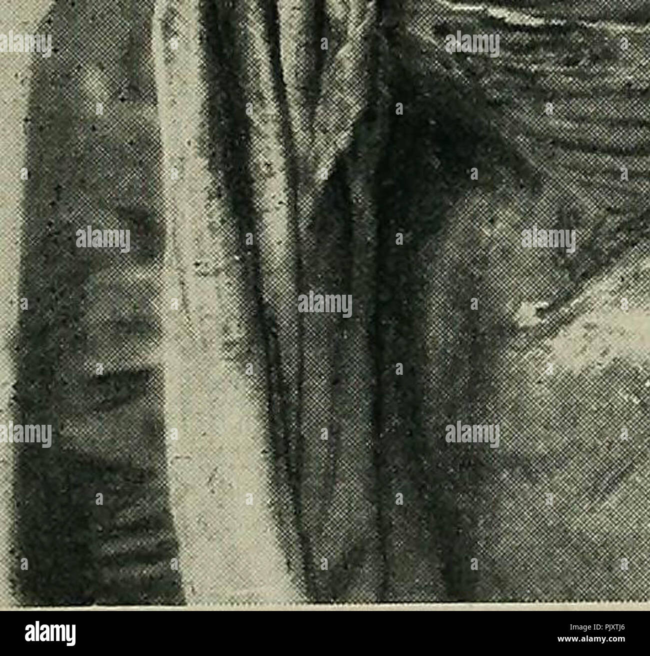 Postmortem pathology manual technic post mortem Fotos und