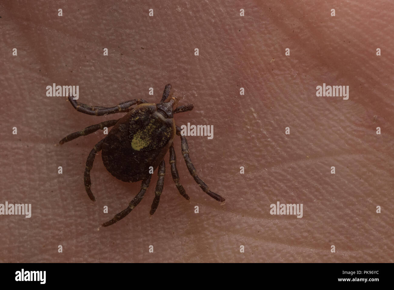 Ein eingebettetes tick aus Peru, Zecken sind als Überträger von Krankheiten, die die menschliche Gesundheit weltweit beeinflussen. Stockfoto