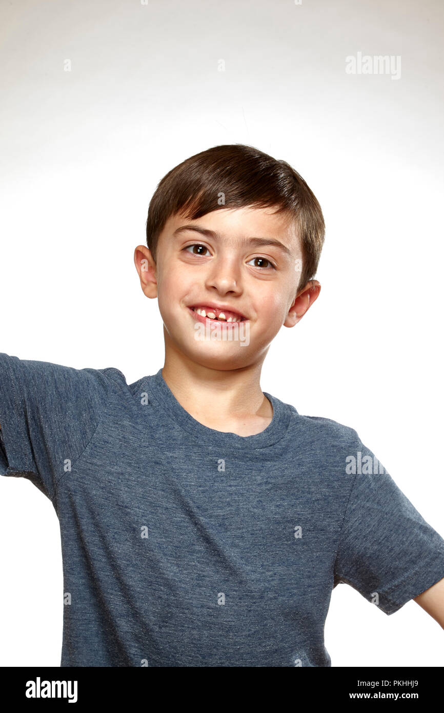 Junge mit schlechten Zähnen Stockfoto