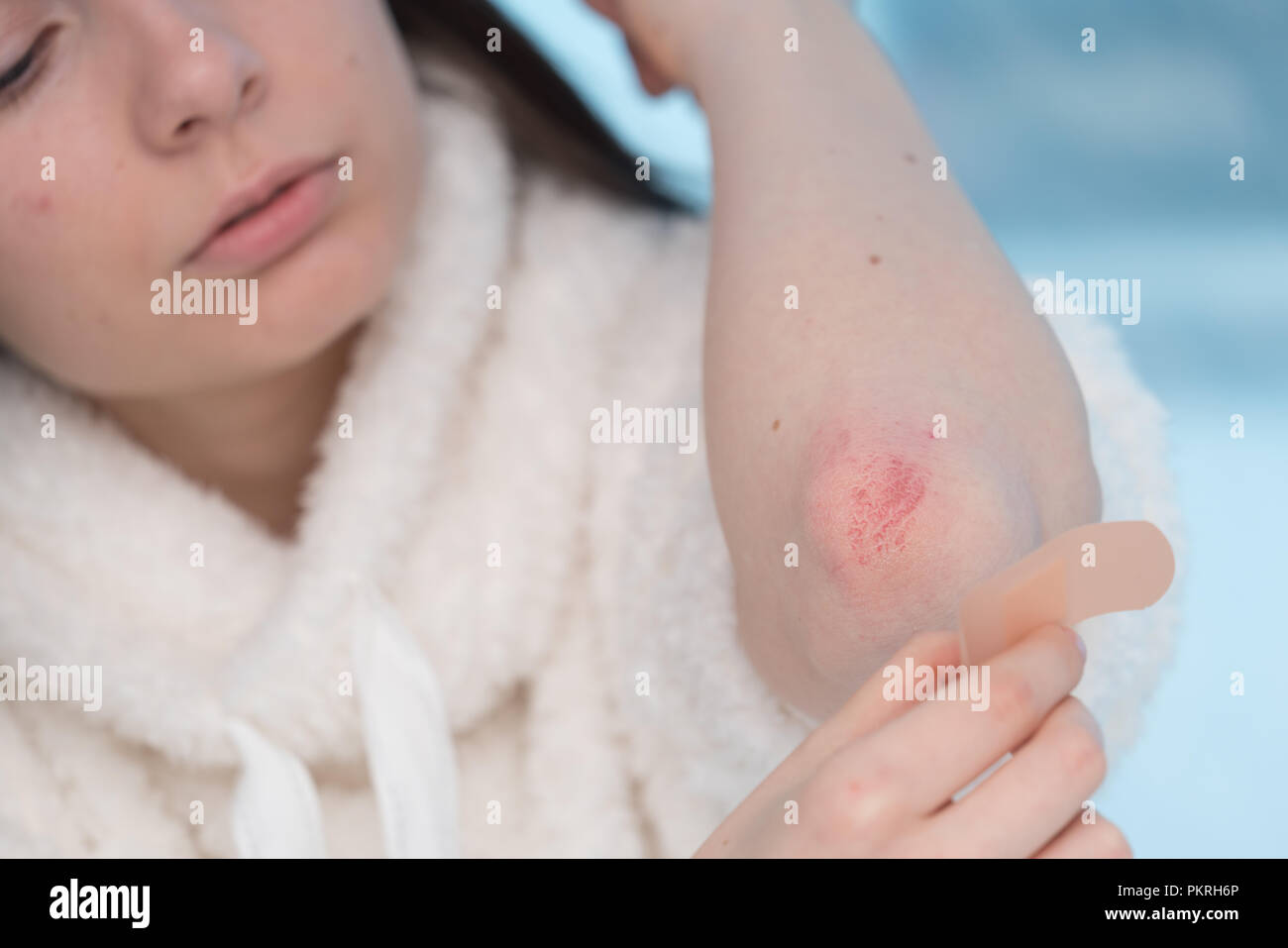 Frau mit Klebeband auf der Hand. Stockfoto