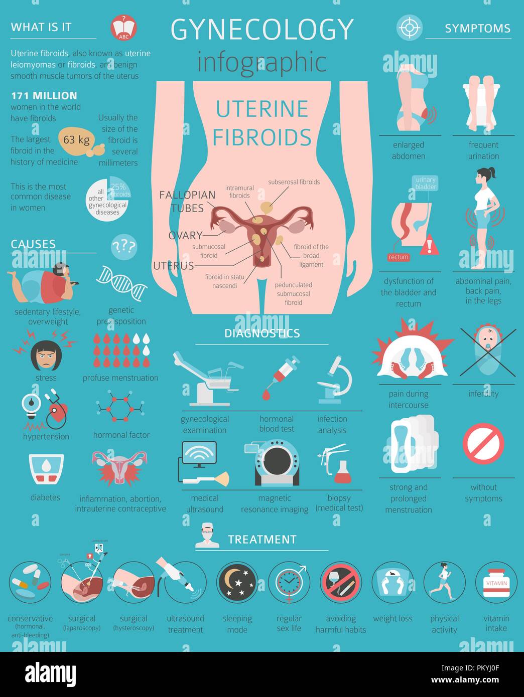 Uterusmyome. Ginecological medizinische Krankheit bei Frauen Infografik. Vector Illustration Stock Vektor