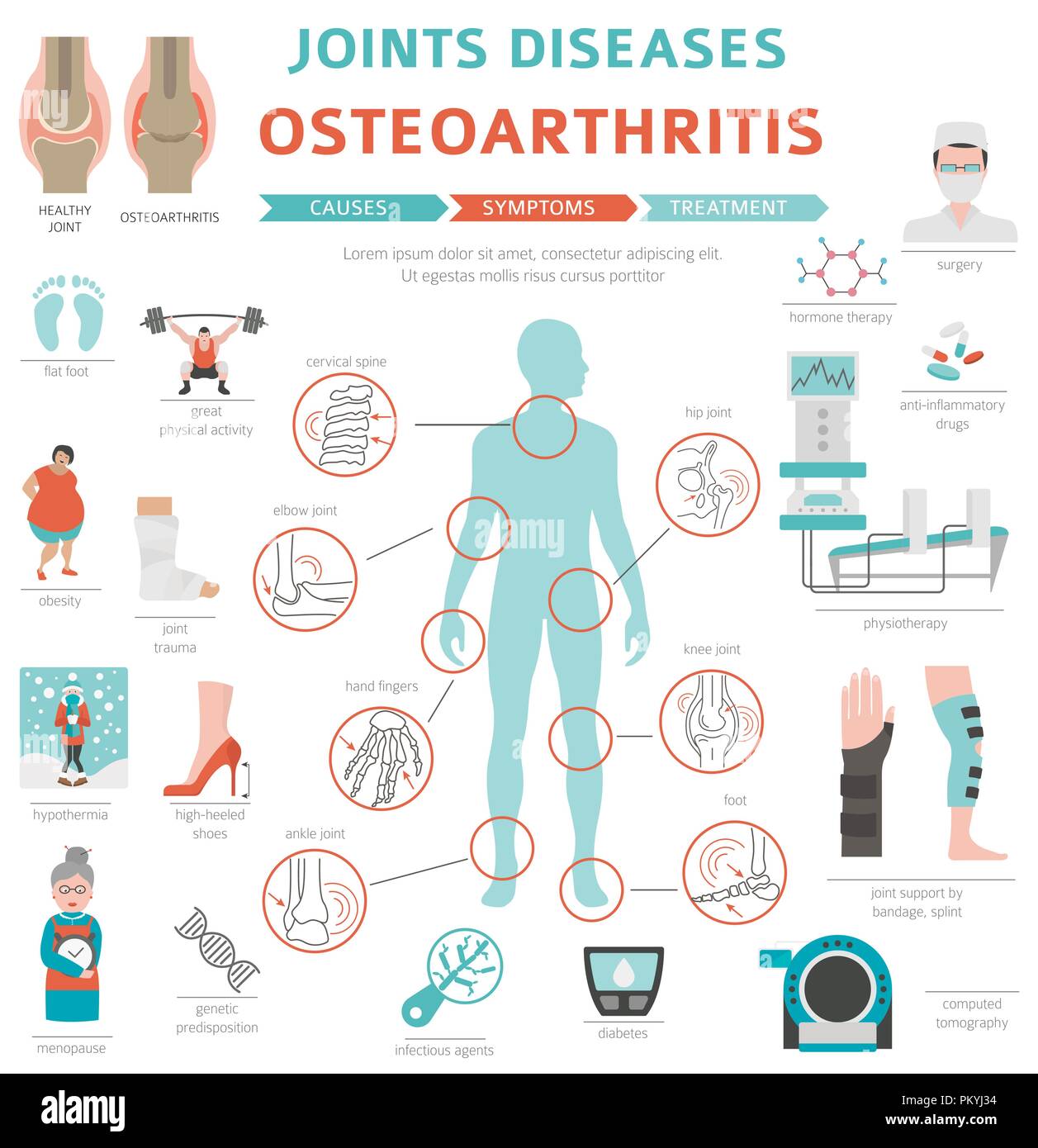 Gelenke Krankheiten. Arthritis, Arthrose Symptome, Behandlung Icon Set. Medizinische Infografik Design. Vector Illustration Stock Vektor
