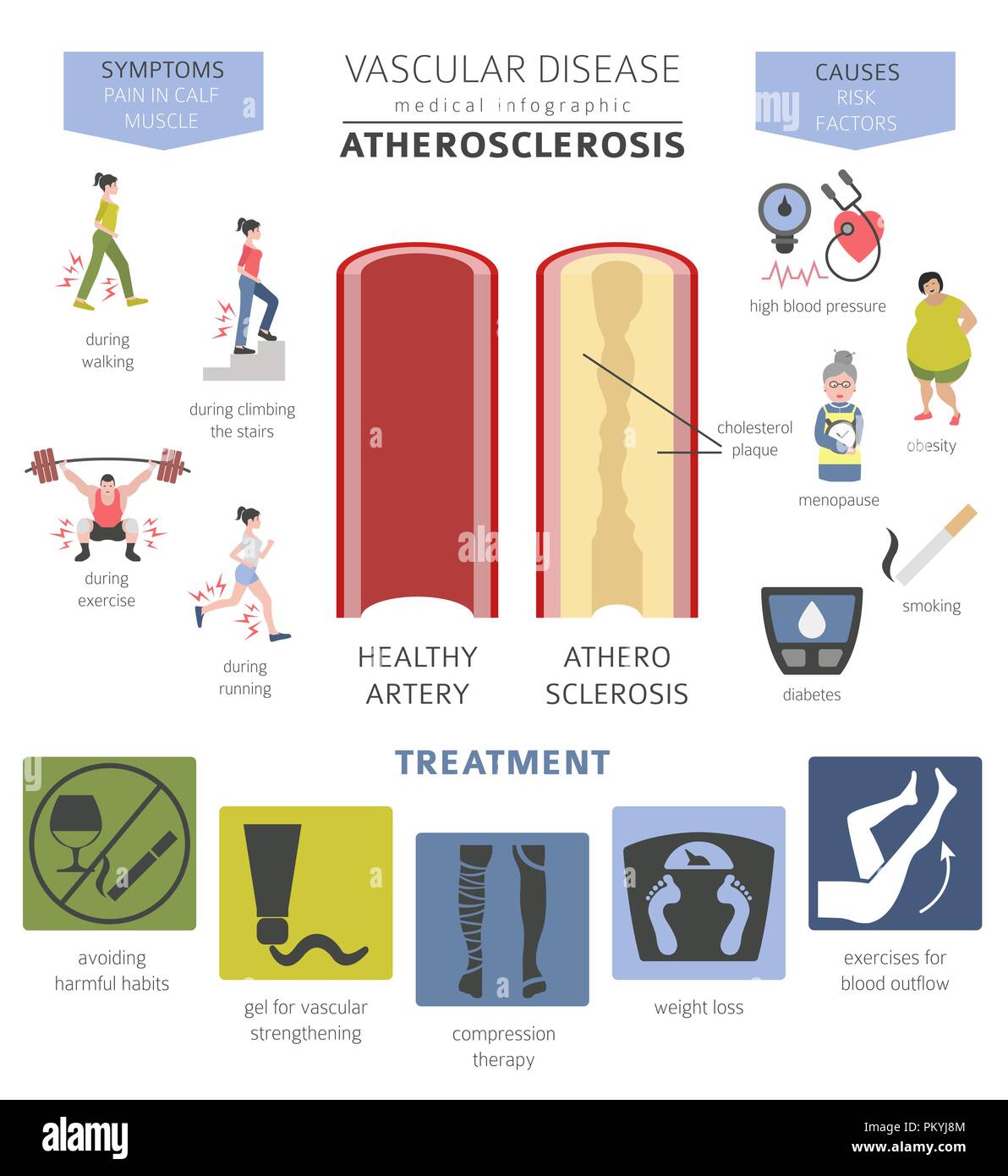 Gefäßerkrankungen. Arteriosklerose Symptome, Behandlung Icon Set. Medizinische Infografik Design. Vector Illustration Stock Vektor