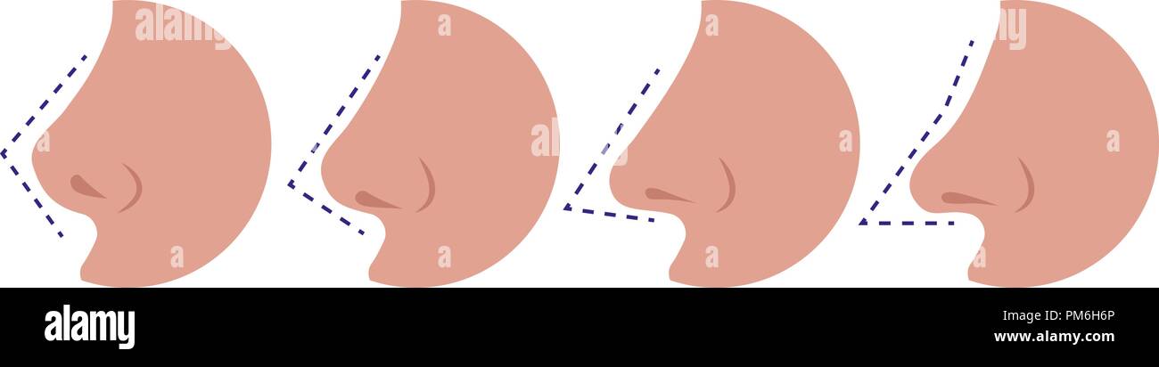 Vector Illustration verschiedene weibliche Nasen Stock Vektor