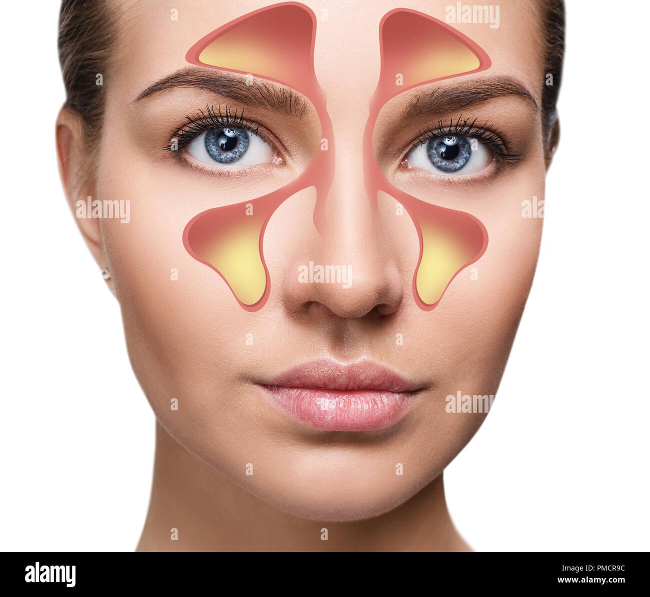 Weibliche Gesicht zeigt nasal Sinus mit kalten weißen Hintergrund. Stockfoto