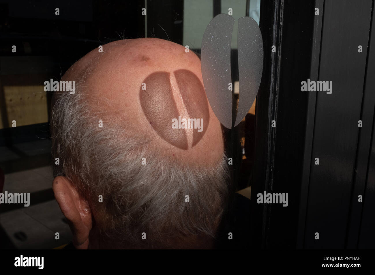 Sonnenlicht erzeugt eine kaffeebohne Schatten auf einem kahlen Kopf Stockfoto