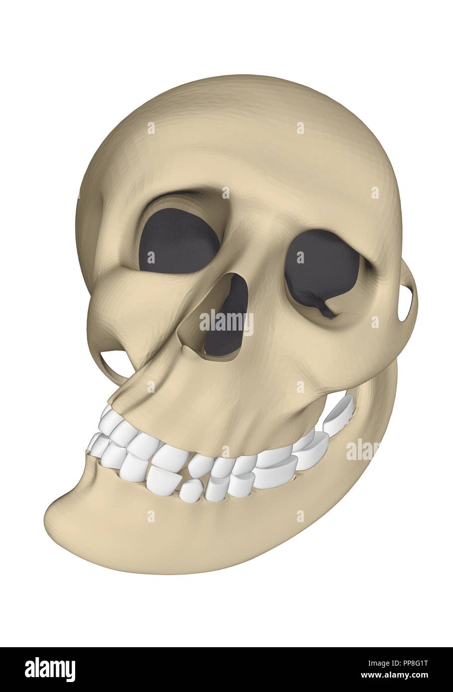 Deformierten menschlichen Schädel im Comic-stil. 3D. Vector Illustration. Stock Vektor