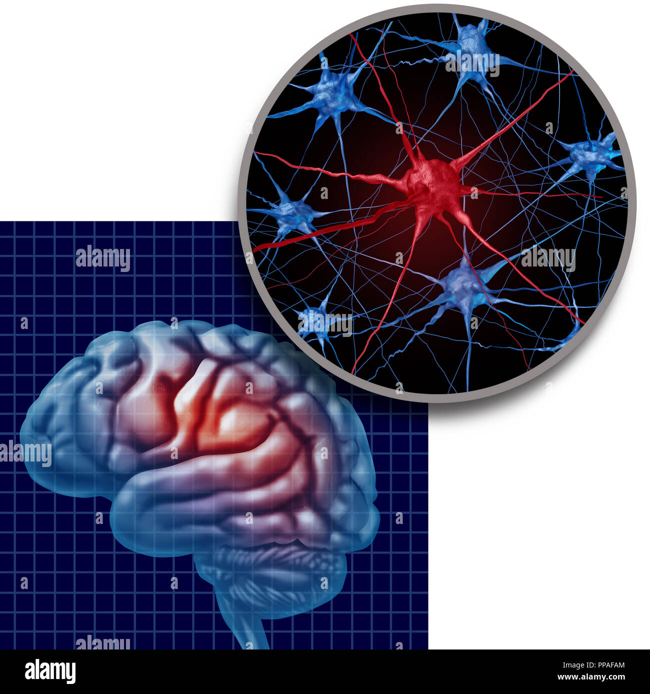 Parkinson die Anatomie des Gehirns Konzept Parkinsons Patienten und Parkinson Erkrankung Symptome wie ein menschlicher Kopf mit Neuronen. Stockfoto