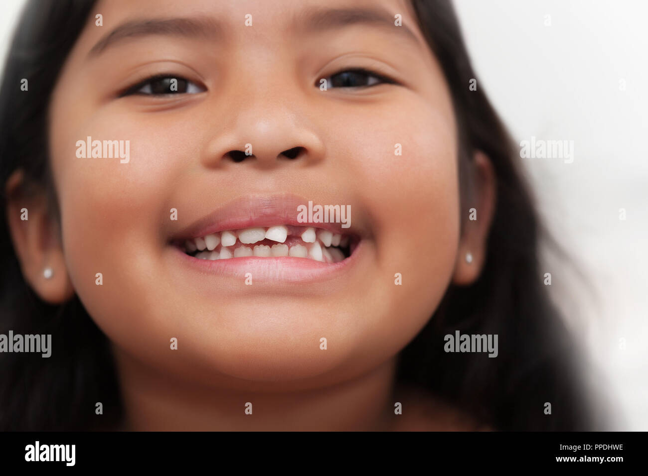 Gerne Latino girl mit lockeren zentralen Schneidezahns Zahn und Zahn daneben Stockfoto