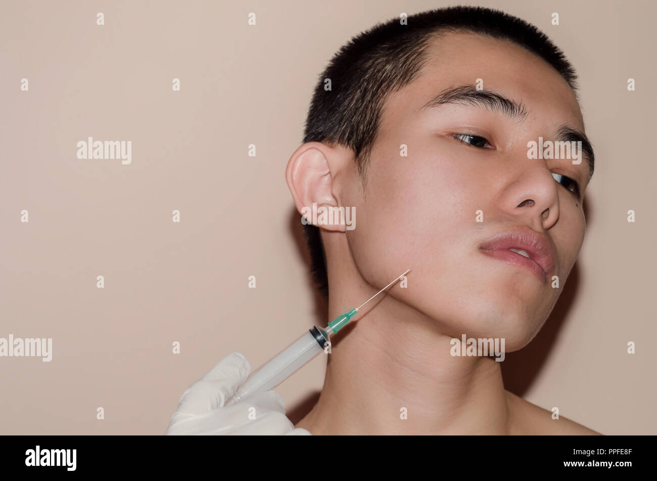Junger Mann mit schönen Gesicht nach der Behandlung von Akne und Pickel, nach der Fläche mit von Narben und Falten durch Akne Ausbau. Glatte Haut durch treatm Stockfoto