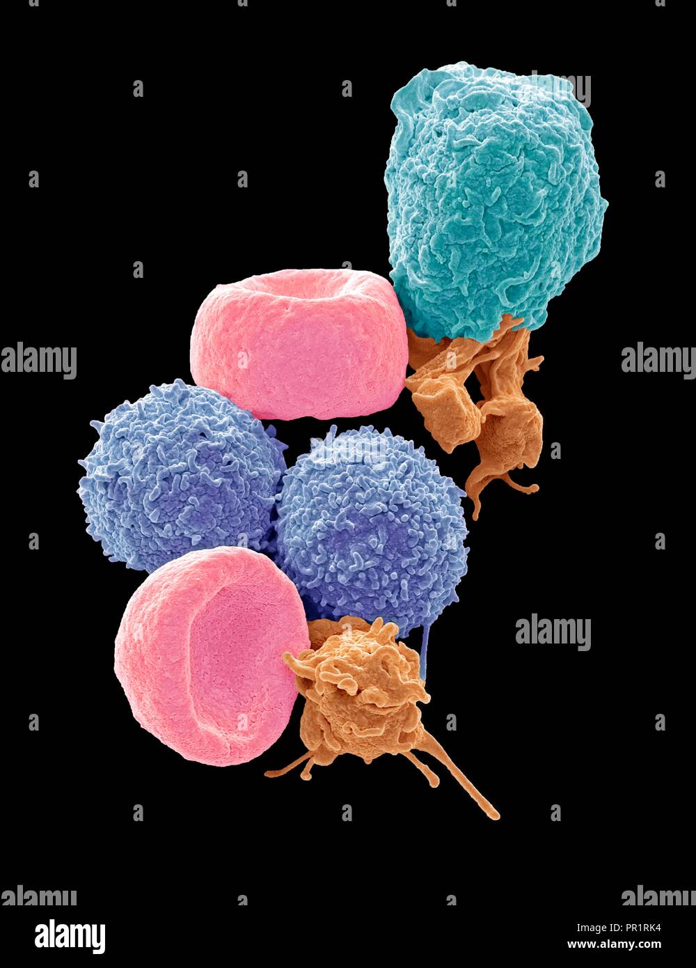 Blutzellen. Farbige Scanning Electron Micrograph (SEM) der menschlichen roten Blutkörperchen (Erythrozyten), weißen Blutkörperchen (Leukozyten, Blau und Magenta) und Blutplättchen (Thrombozyten, Orange). Die Scheibenförmigen, biconcave Erythrozyten transportieren Sauerstoff zu den Zellen des Körpers und Kohlendioxid in die Lunge zu entfernen. Leukozyten sind Teil des Immunsystems, die Verteidigung des Körpers gegen eine Infektion durch die Aufnahme von Pathogenen durch Phagozytose oder durch die Produktion von Antikörpern. Vergrößerung: x5000, wenn 10 Zentimeter hohe gedruckt. Stockfoto