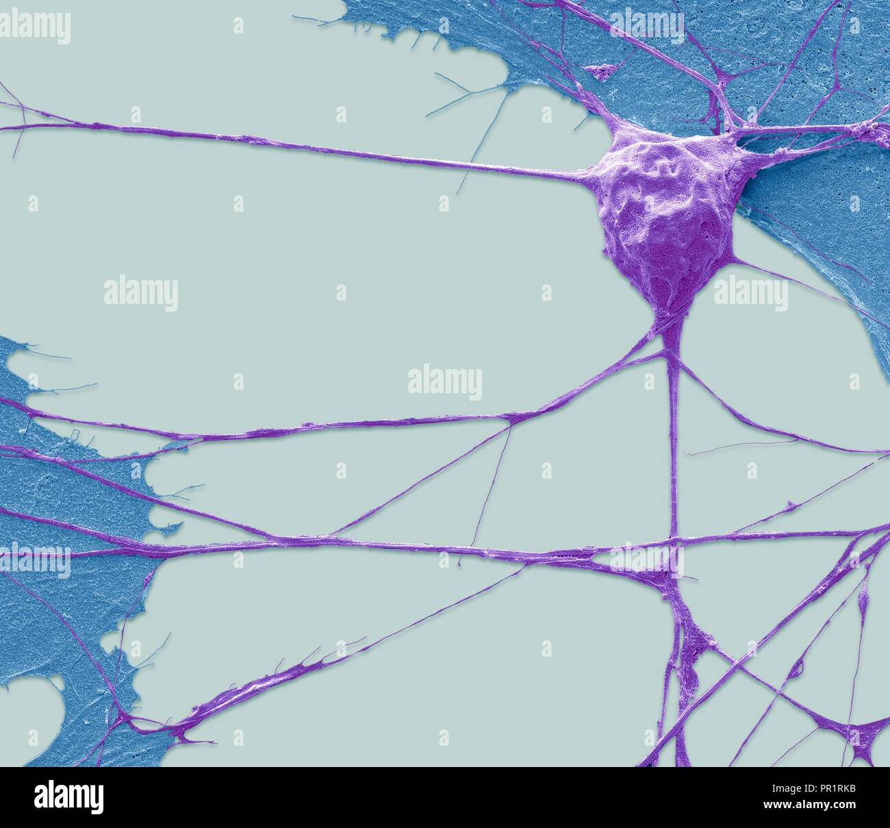 Stem Cell-derived Motor Neuron. Farbige Scanning Electron Micrograph (SEM) eines menschlichen Nervenzelle (Neuron), der sich aus einer embryonalen pluripotenten Stammzellen abgeleitet wurde (ES). Pluripotente Stammzellen sind in der Lage, in einem der 200 Zelltypen des menschlichen Körpers differenzieren. Die Art der Zelle, die sie zu reifen hängt von der biochemischen Signalen von der unreifen Zellen erhalten. Diese Fähigkeit macht sie eine potentielle Quelle von Zellen beschädigtes Gewebe in Krankheiten wie Parkinson und Insulin-abhängigen Diabetes zu reparieren. Vergrößerung: x1500, wenn gedruckt 10 Zentimeter in der Breite Stockfoto