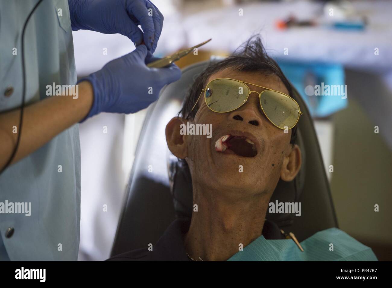 Luong Van Kiem sitzt auf einem Behandlungsstuhl, nachdem ein Zahn während der Pacific Engel (PAC ENGEL) 18-2 im Kulturzentrum Haus der Tam Giang Gemeinde im Nui Thanh extrahiert, Provinz Quang Nam, Vietnam, Sept. 12, 2018. PAC ENGEL ist eine multilaterale humanitäre Hilfe zivil-militärische Engagement, das Militär verbessert die militärische Partnerschaften im Indopazifik, während auch die medizinische Gesundheit Outreach, Civic Engineering Projekte und den Austausch unter den Partner Kräfte. Stockfoto