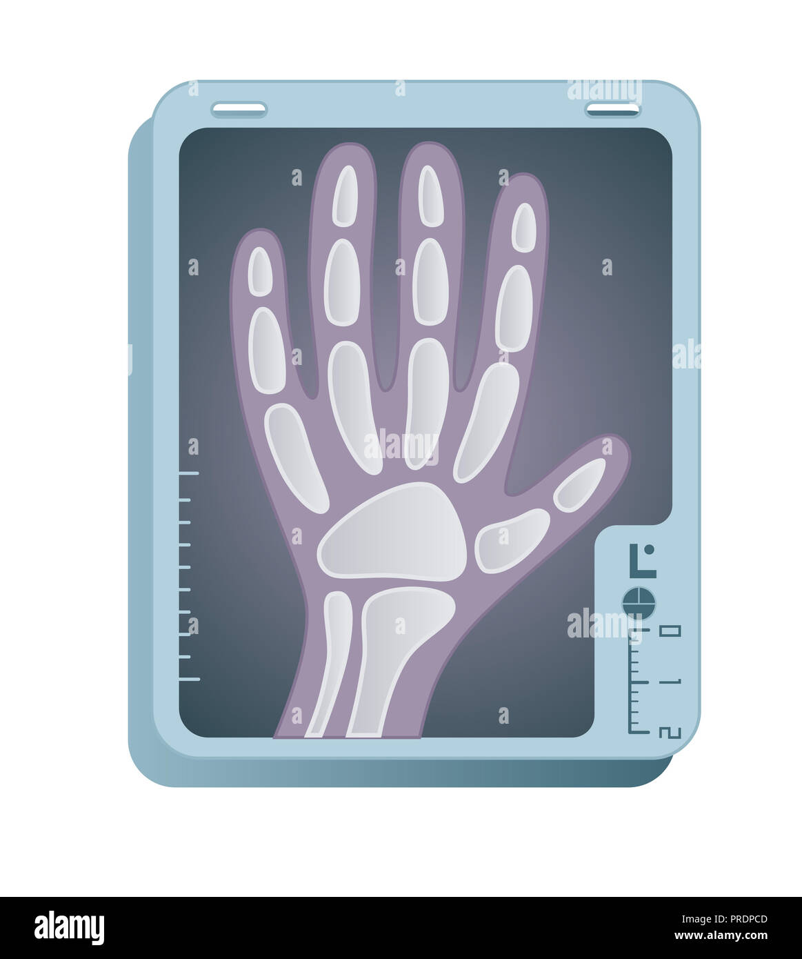 Röntgen der hand Stockfoto