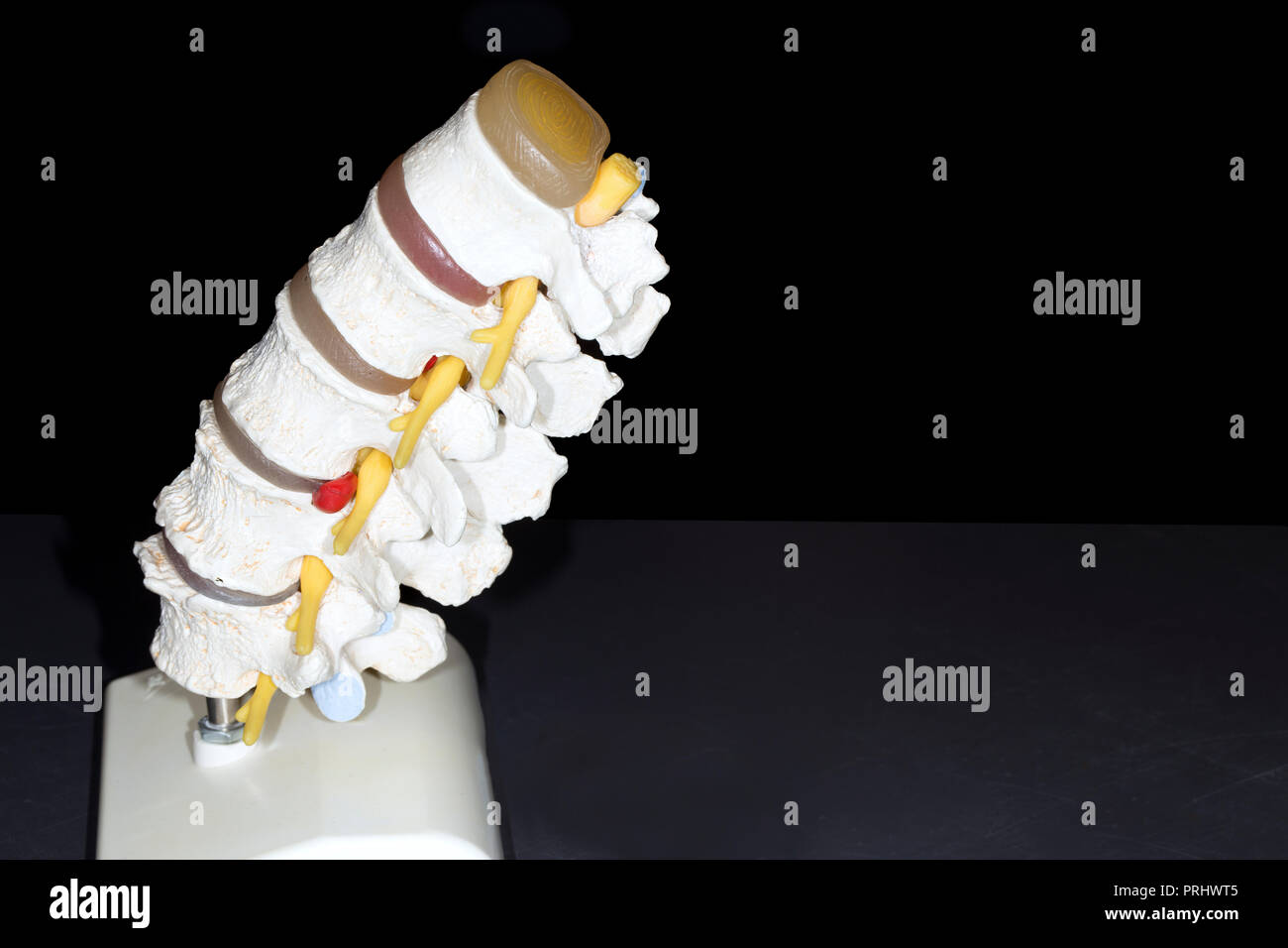 Seitenansicht Modell Wirbelsäule Wirbelsäule von fünf Wirbel auf schwarzen Hintergrund mit Platz für Text Stockfoto