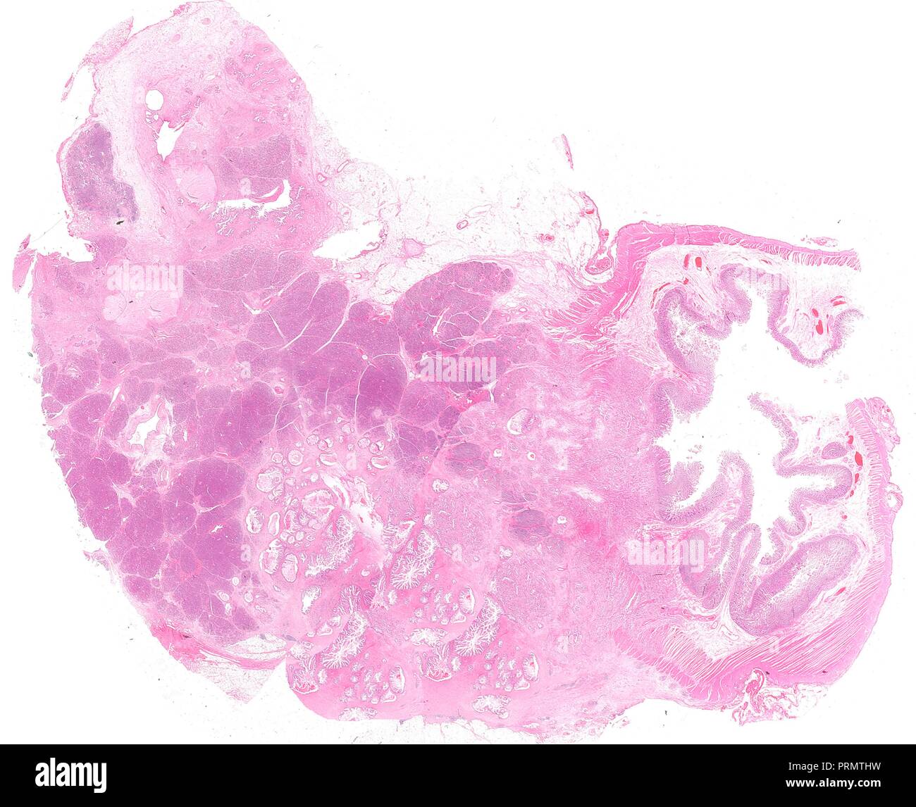 Menschliches Gewebe Schichten, close-up der inneren Organe. Stockfoto