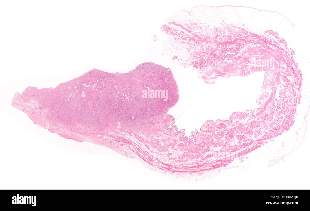 Menschliches Gewebe Schichten, close-up der inneren Organe. Stockfoto