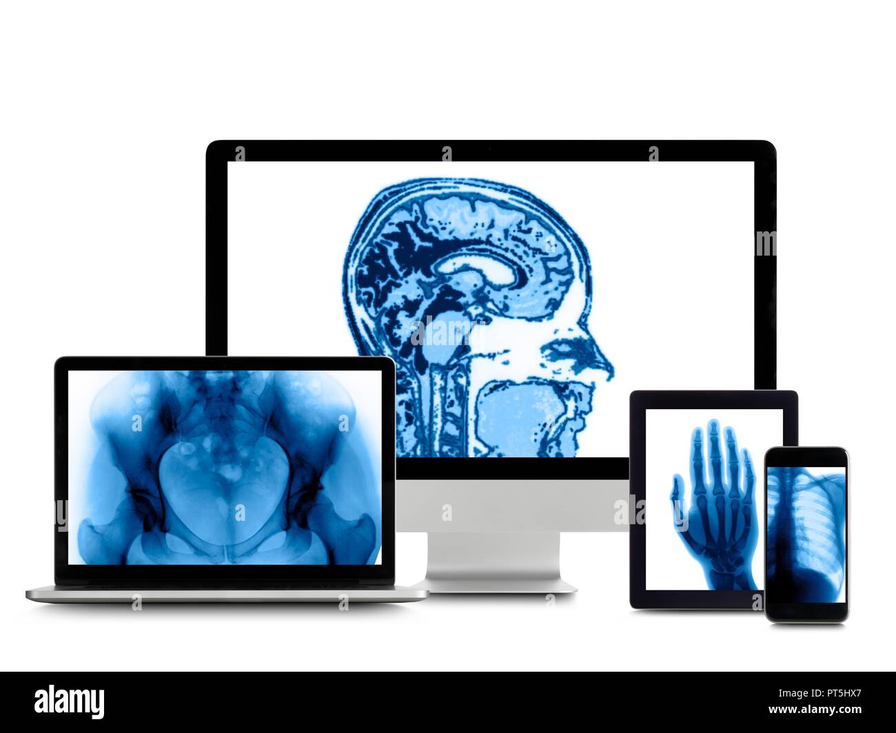 X-ray Bilder auf digitalen Bildschirmen des Geräts. Stockfoto