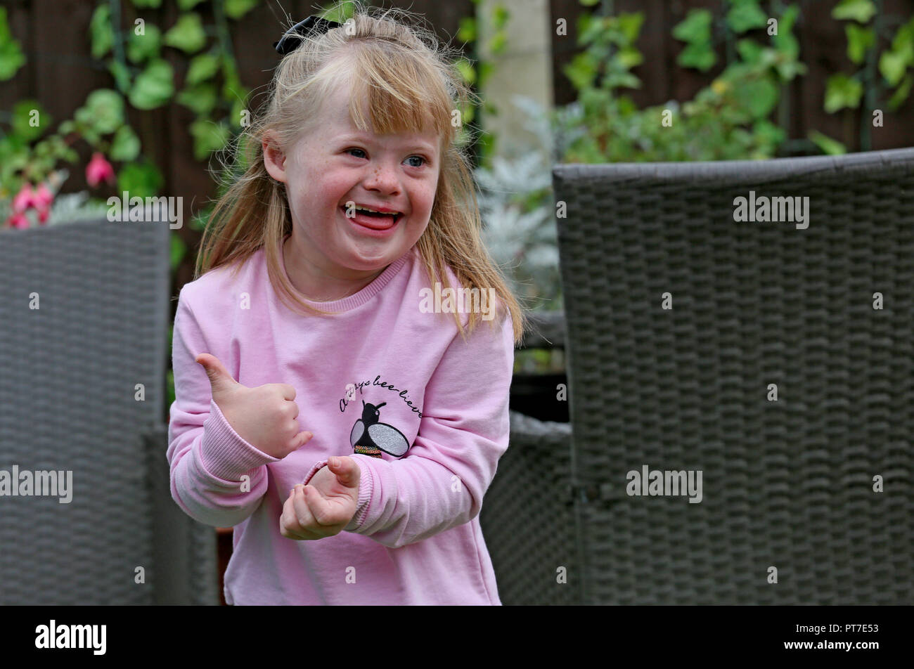 Trisomie 21 Syndrom Stockfotos Und Bilder Kaufen Alamy