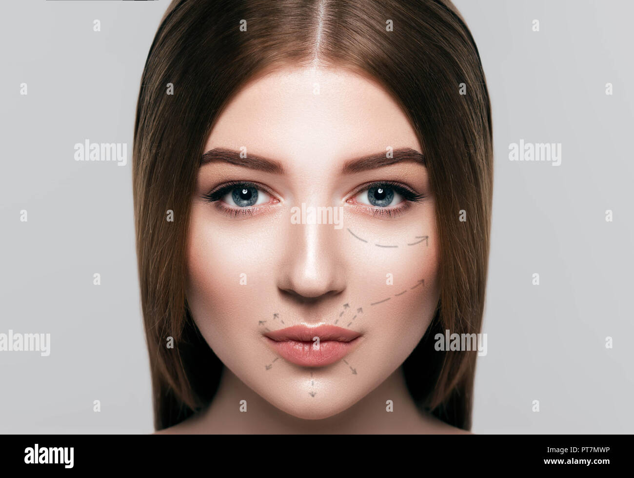 Schöne Frau mit Pfeilen auf Gesicht, Gesichts Chirurgie und Botulinumtoxin Injektion Stockfoto