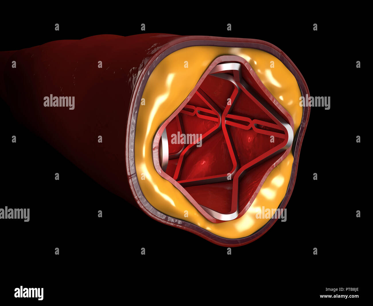 Herz Stent 3D-Illustration isolierten schwarzen Hintergrund. Stockfoto