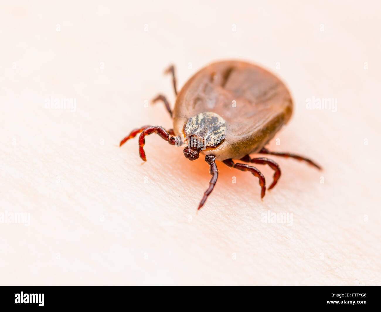 Enzephalitis Virus oder Lyme Krankheit infizierten Zecke Dermacentor Spinne Insekt auf der Haut Makro Stockfoto Enzephalitis Virus oder Lyme Krankheit infizierten Zecke Dermacentor Spinne Insekt auf der Haut Makro Stockfoto