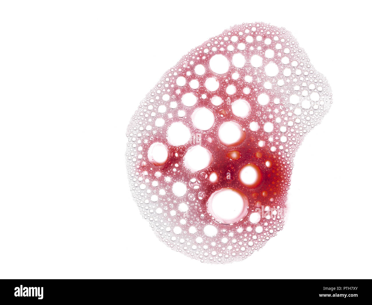 Blut auf Zahnpasta Schaum, Zahnfleischbluten Symptom, schlechte zahnmedizinische Mundhygiene. Stockfoto