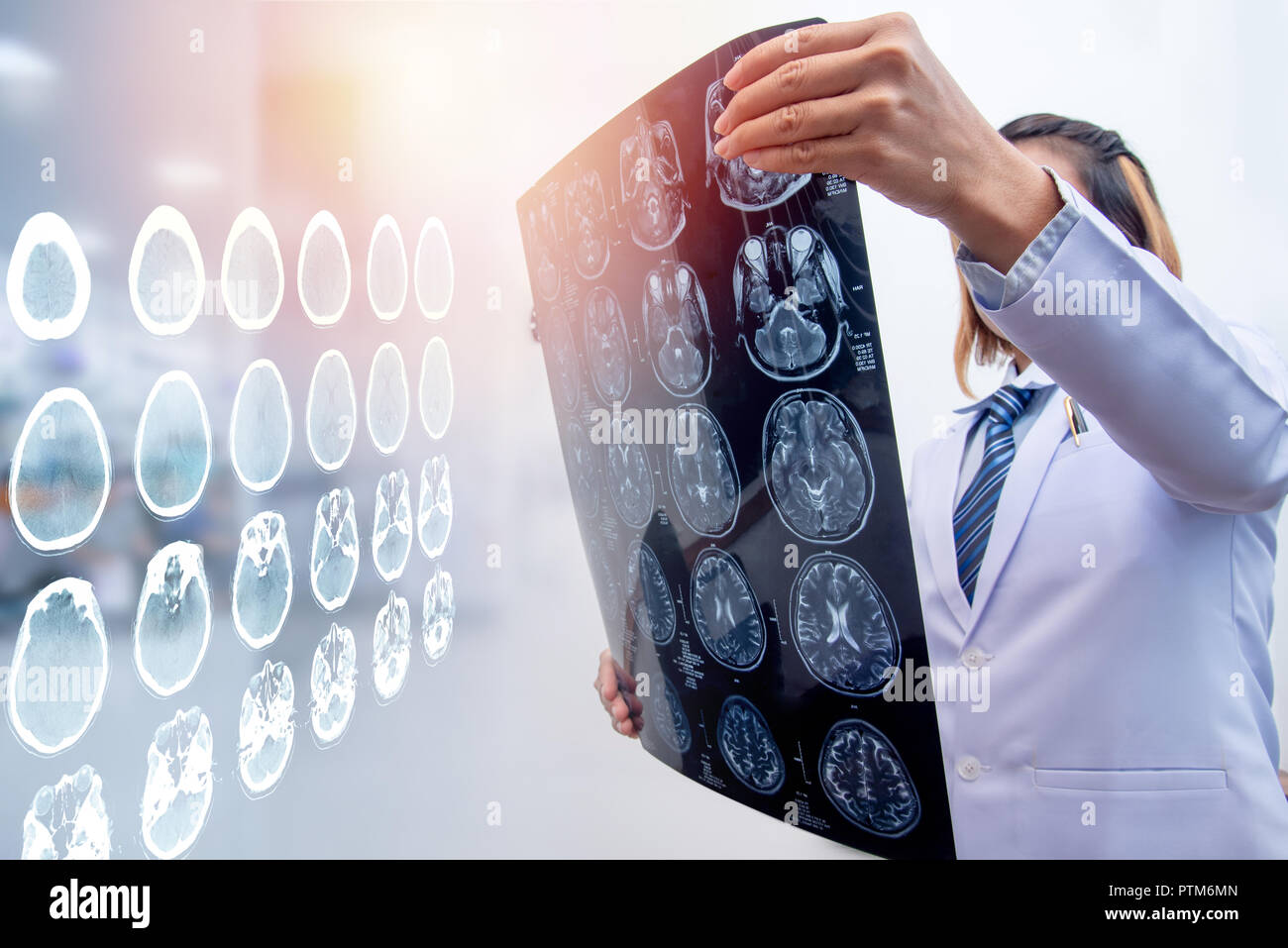 Frau Doktor holding MRI Film zur Diagnose von Verletzungen des Gehirns mit Double Exposure von Gehirn-CT-Scan Stockfoto