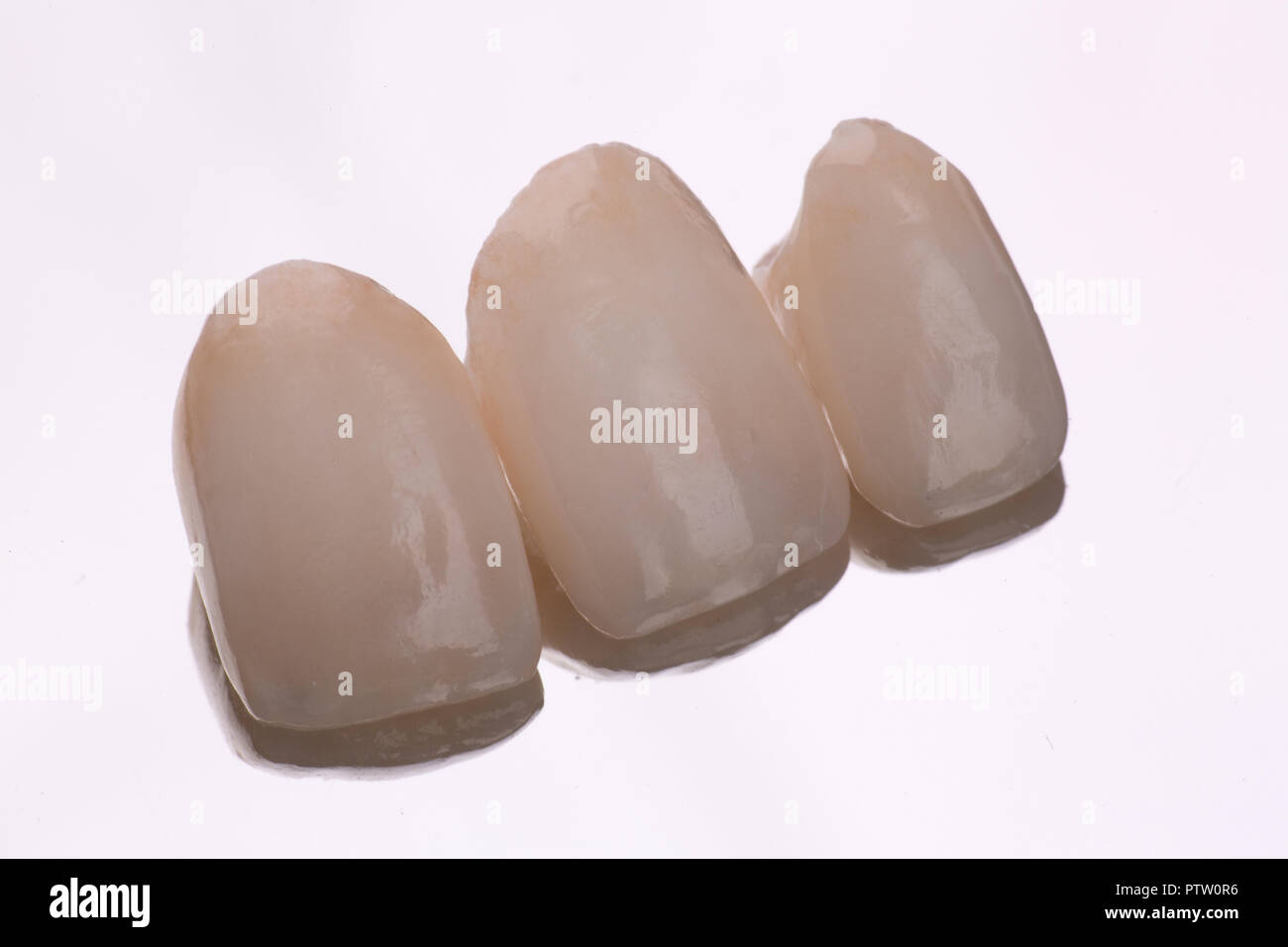Dental Keramik Veneers und Kronen mit Spiegel Hintergrund isoliert Stockfotografie Alamy