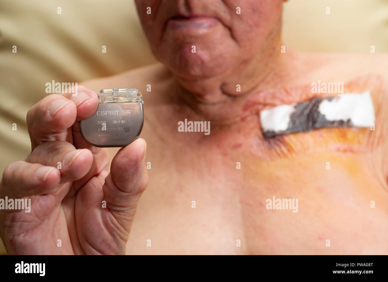 NHS-Patienten Holding ein Friedensstifter nach Chirurgie mit neuen Gerät zu aktualisieren, Stockfoto