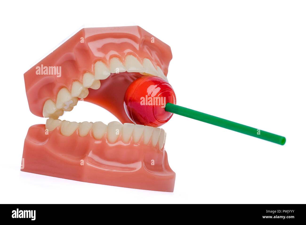 Kieferorthopädische Zähne Modell mit roten Lutscher Stockfoto