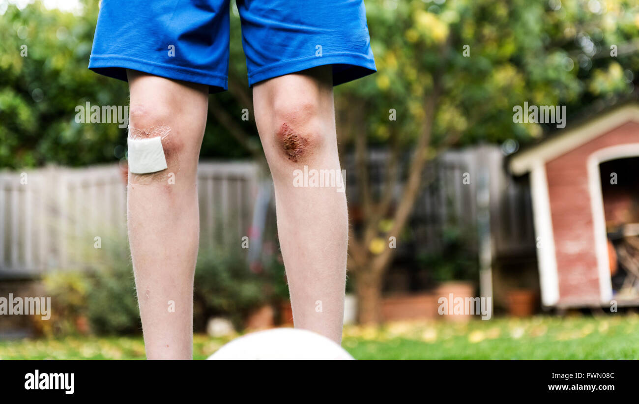 Wounded Knee eines Jungen Fußball spielen im Garten. Stockfoto