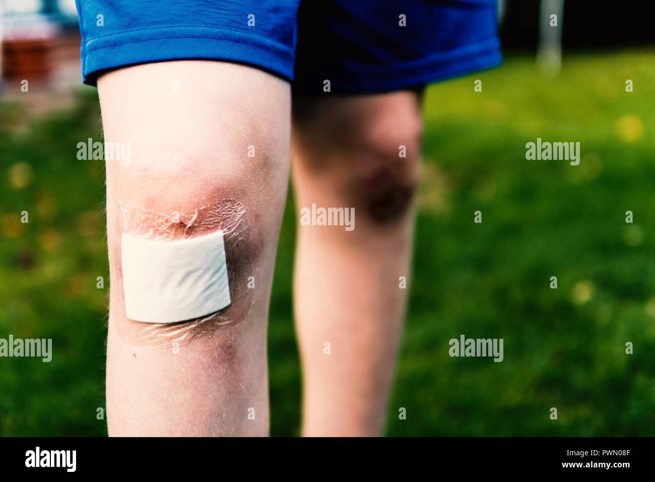 Putz auf Wounded Knee eines Jungen spielen im Garten. Stockfoto