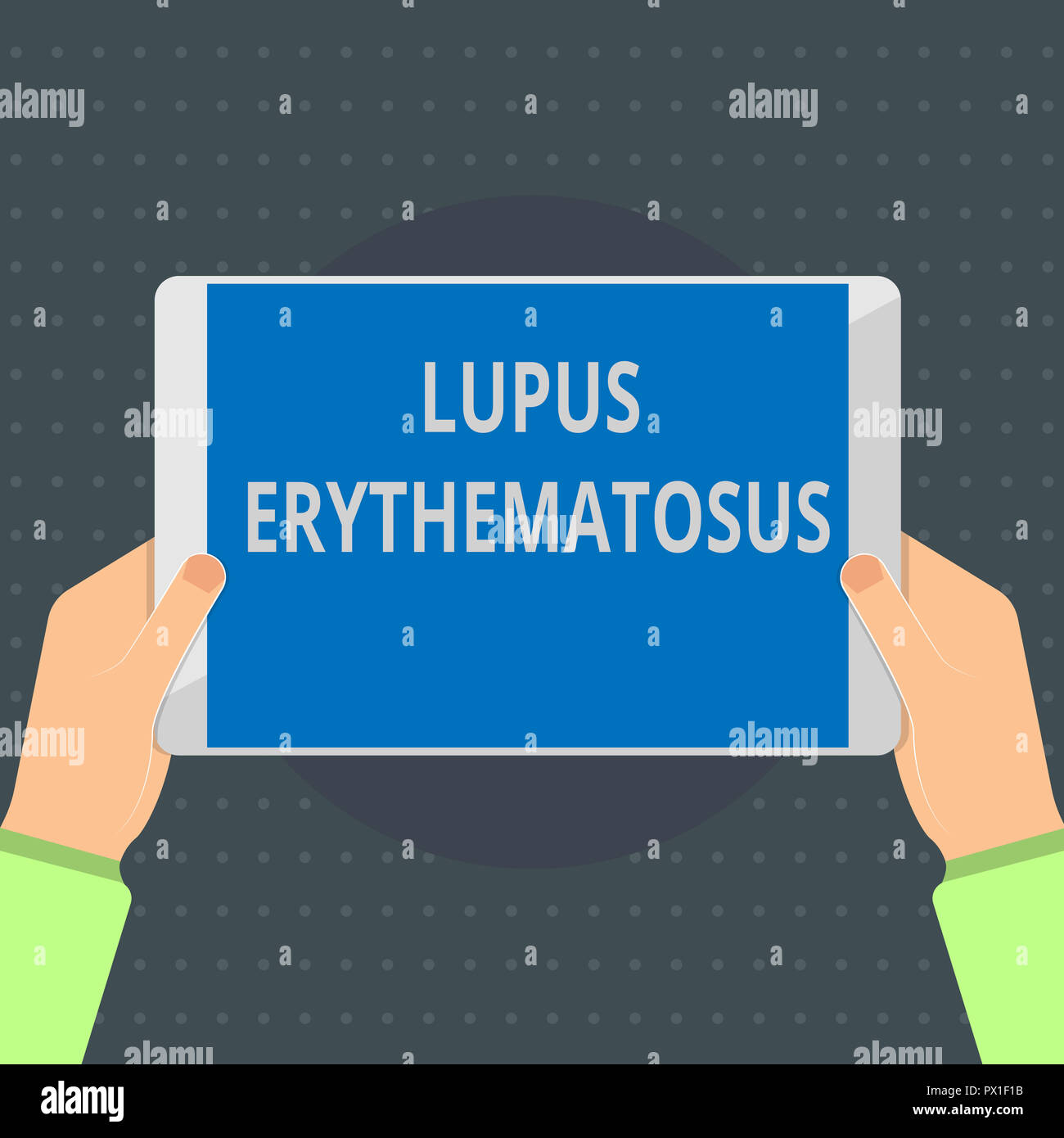 Text Zeichen zeigen, Lupus erythematodes. Konzeptionelle Foto entzündliche Erkrankung, die durch eine Autoimmunerkrankung verursacht. Stockfoto