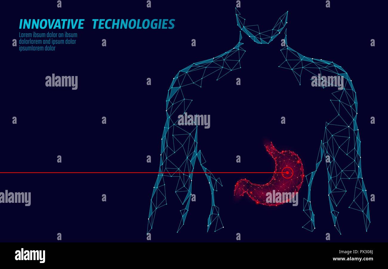 Die menschliche Gesund Medizin medikamentöse Behandlung magen. Interne Verdauung Orgel. Low Poly verbunden dots Grau weißes Dreieck Zukunft Technik Design backgrou Stock Vektor