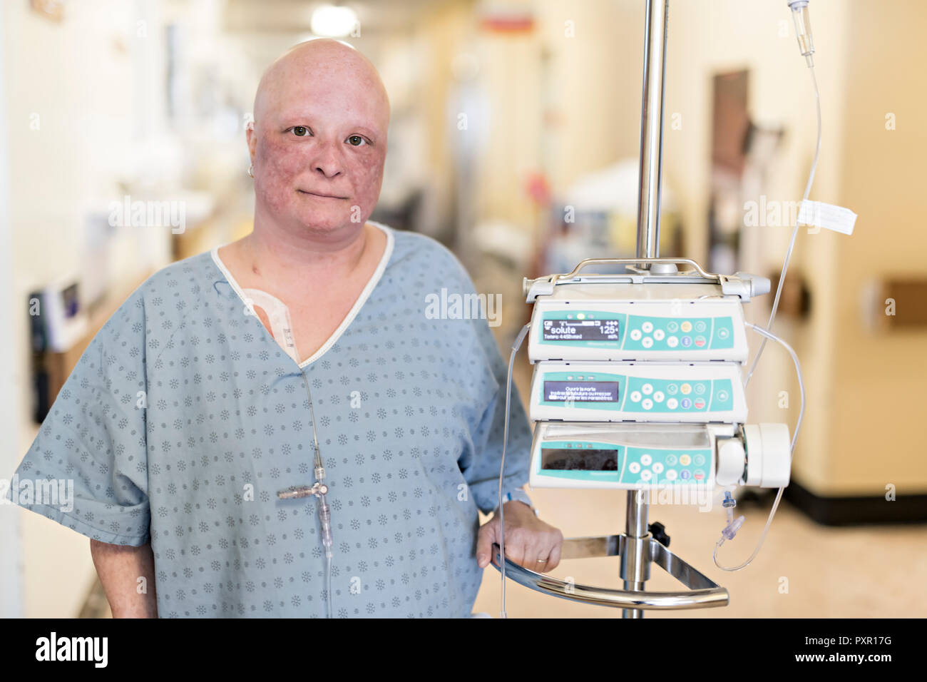 Eine Frau im Krankenhaus, die unter Krebs leiden Stockfoto
