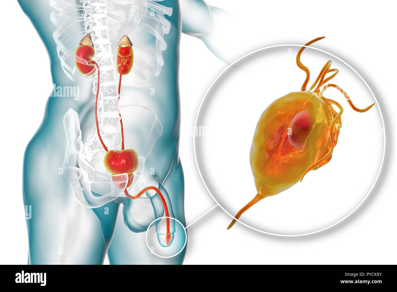 Trichomoniasis, Illustration. Computer Bild der männlichen Geschlechtsorgane und die parasitäre Mikroorganismen Trichomonas vaginalis, dem Erreger der trichomoniasis. Trichomoniasis ist eine häufige Ursache von Urethritis, Prostatitis und ist eine sexuell übertragene Krankheit. Stockfoto