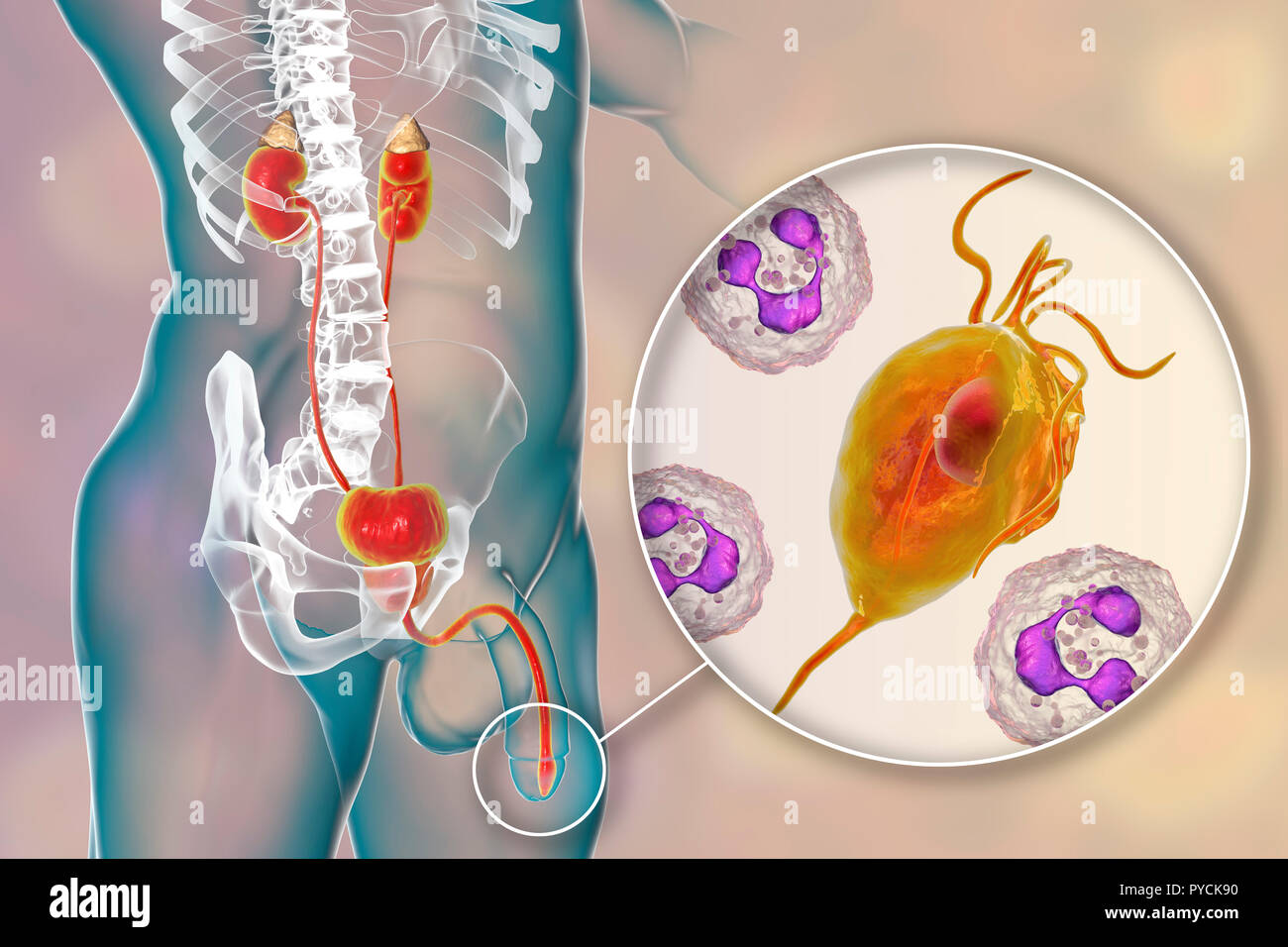 Trichomoniasis, Illustration. Computer Bild der männlichen Geschlechtsorgane und die parasitäre Mikroorganismen Trichomonas vaginalis, dem Erreger der trichomoniasis. Trichomoniasis ist eine häufige Ursache von Urethritis, Prostatitis und ist eine sexuell übertragene Krankheit. Stockfoto