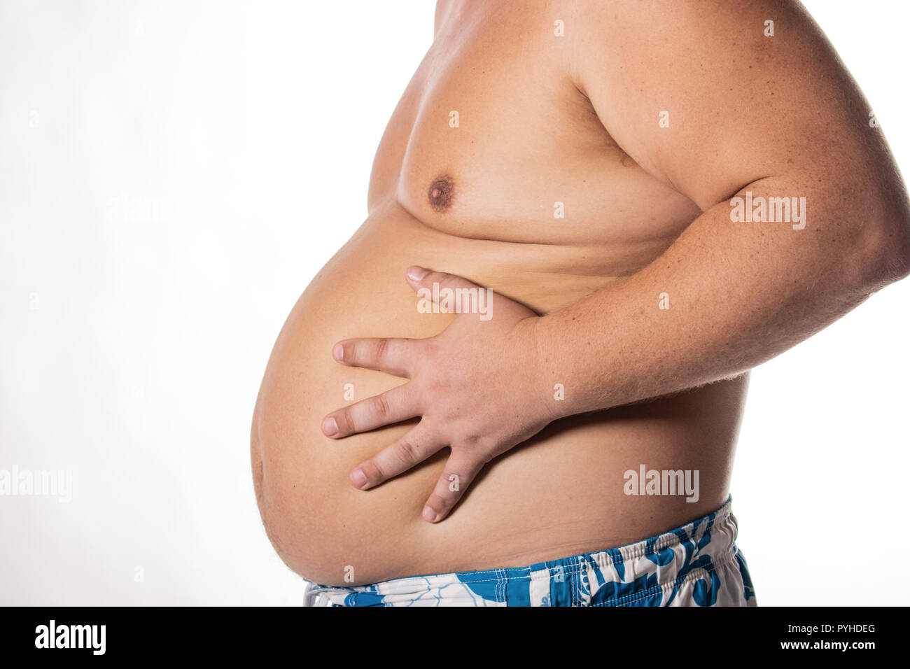 Fetter Mann mit großen Bauch. Gesundheitliche Probleme. Adipositas, eine kranke Leber Stockfoto