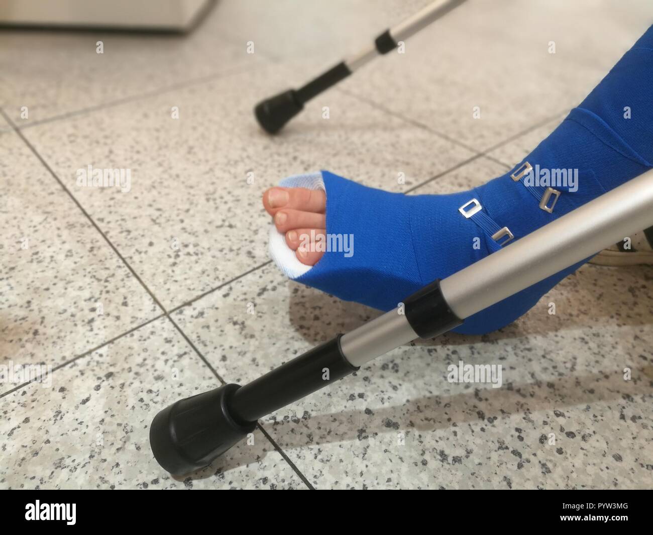 Mädchen mit gebrochenem Bein im Krankenhaus Notaufnahme Stockfotografie Alamy