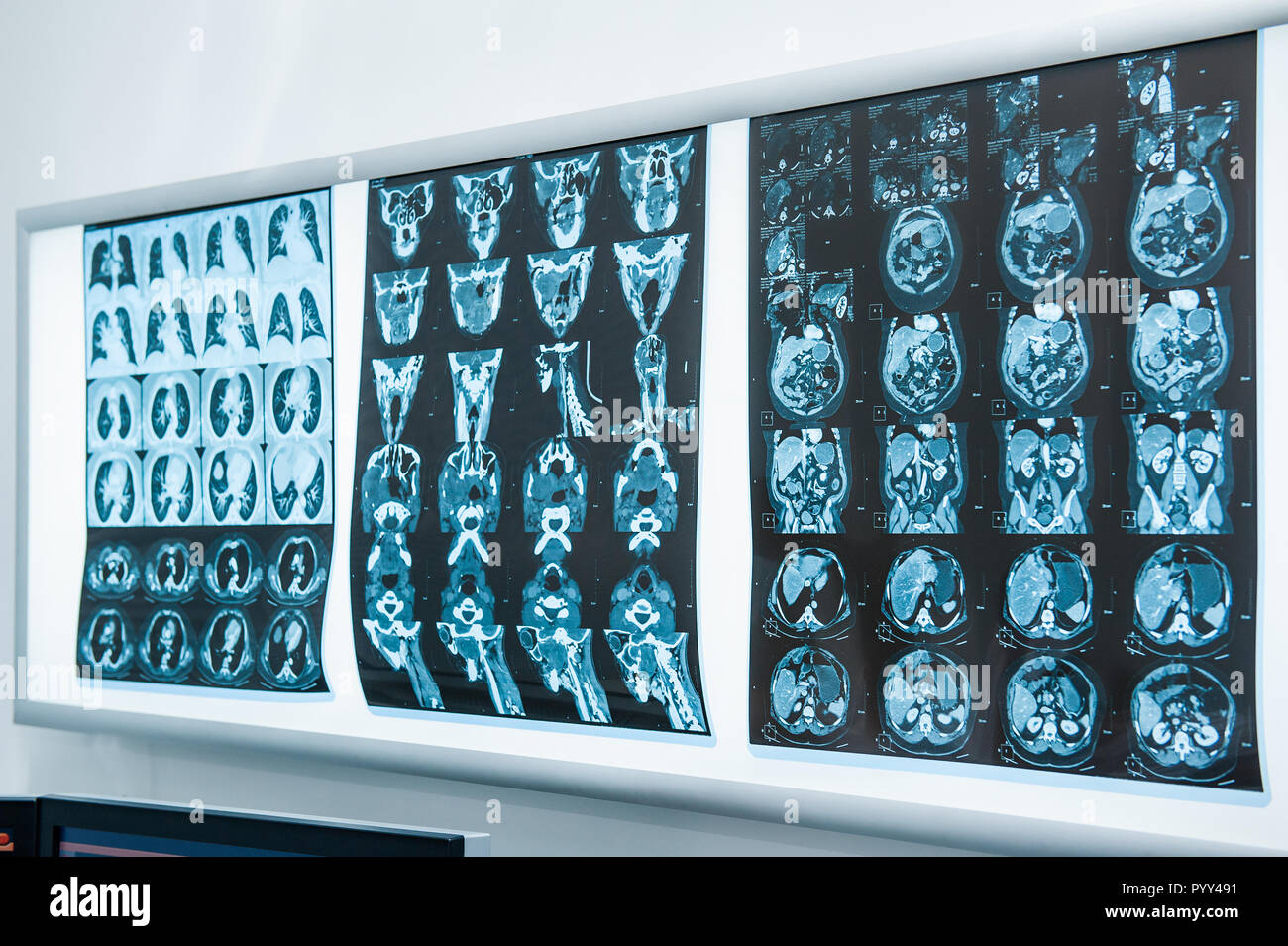 Mehrere Magnetresonanztomographie (MRT) des Gehirns. Selektiver Fokus Stockfoto