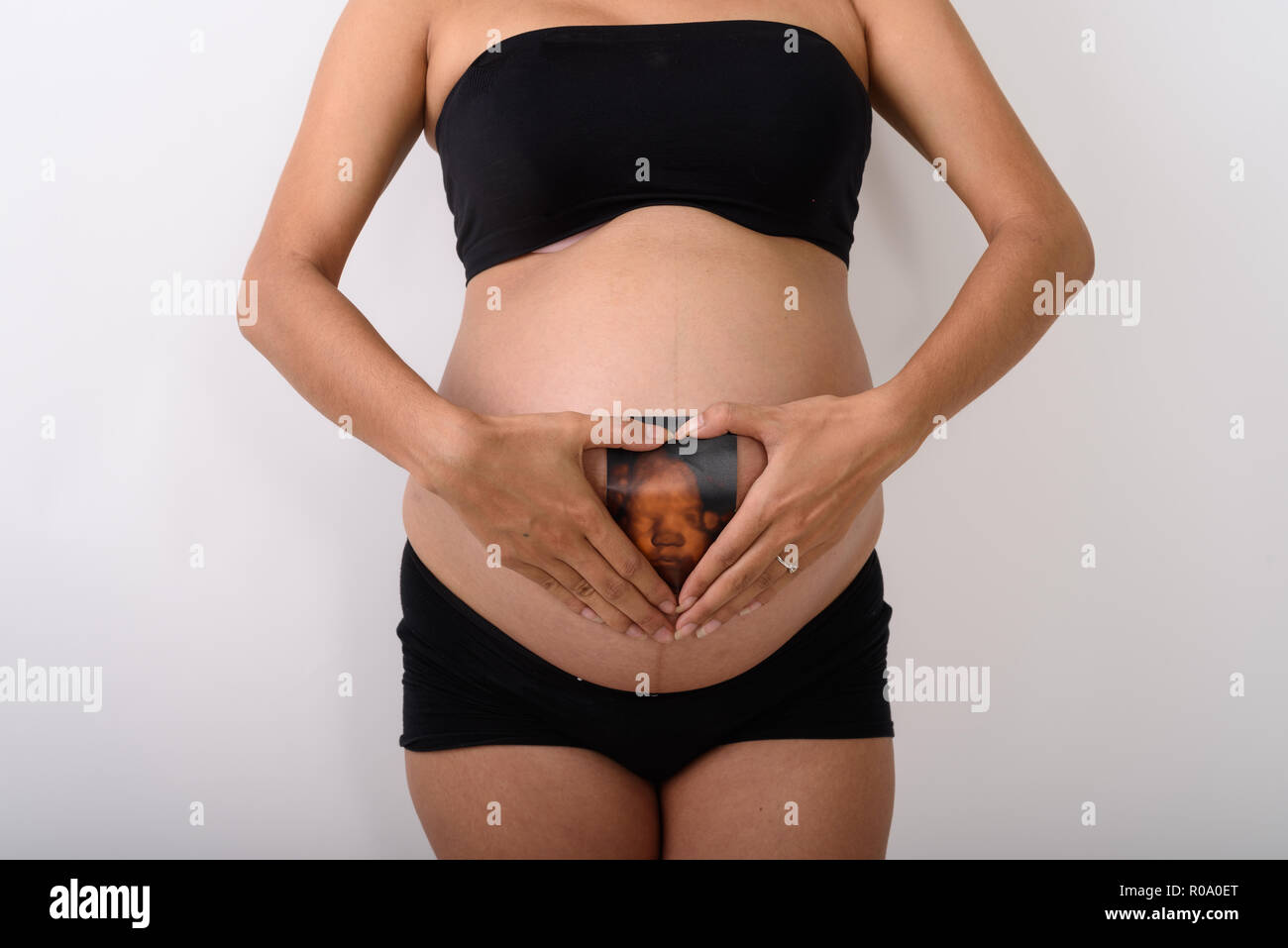 Asiatische schwangere Frau Holding sonogram Ihres Babys Stockfoto