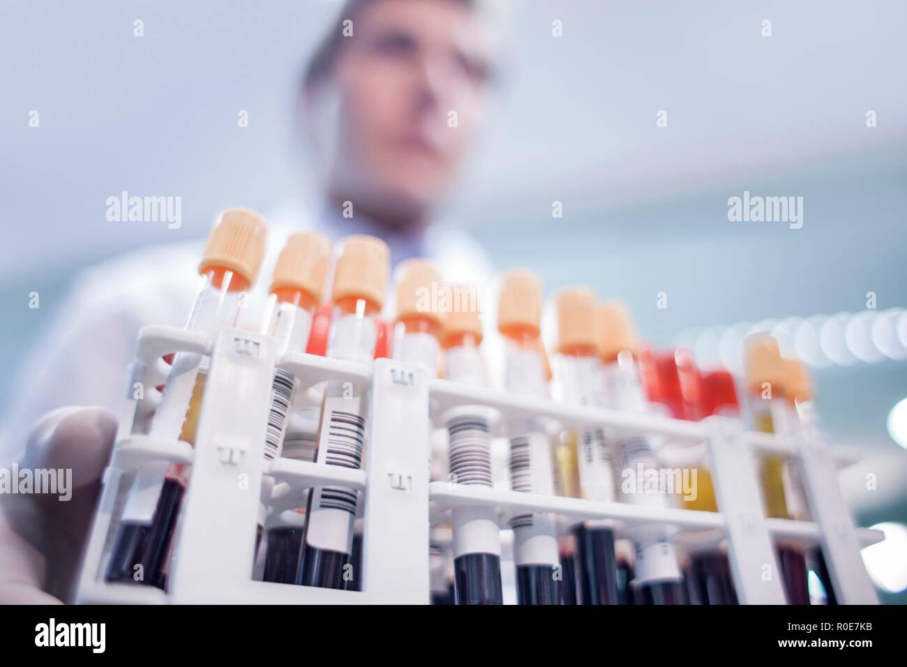 Laboratory Assistant Holding medizinische Proben im Rack. Stockfoto