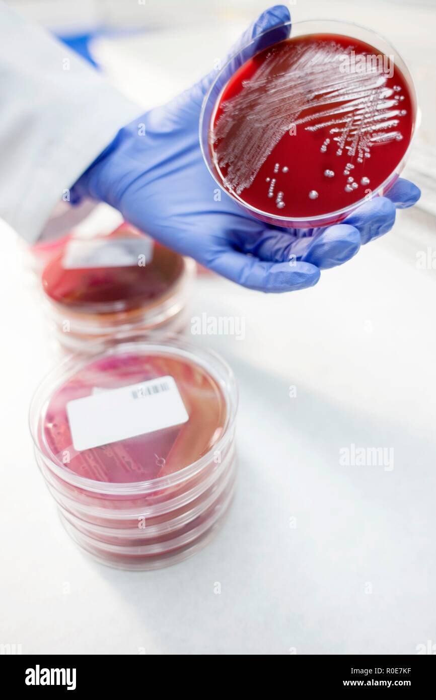 Laboratory Assistant Prüfung Wachstum auf einer Petrischale, aus der Nähe. Stockfoto
