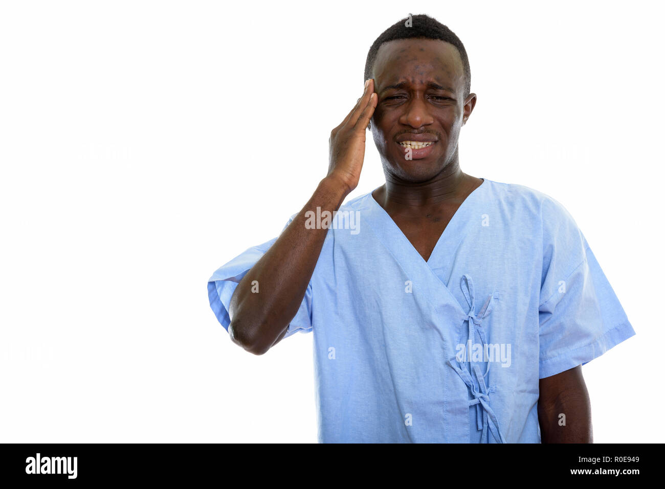 Studio shot von jungen schwarzen afrikanischen Mann Patient mit Kopfschmerzen. Stockfoto