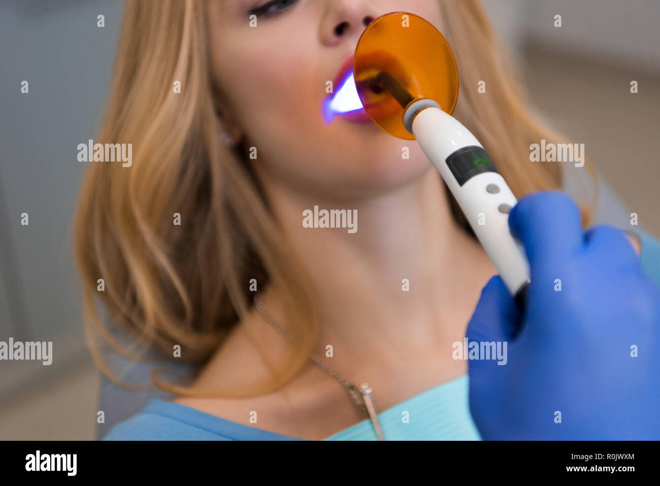 7/8 Schuß von Zahnarzt in Handschuh Verfahren mit zahnmedizinischen Polymerisationslampe für weibliche Kunden Stockfoto