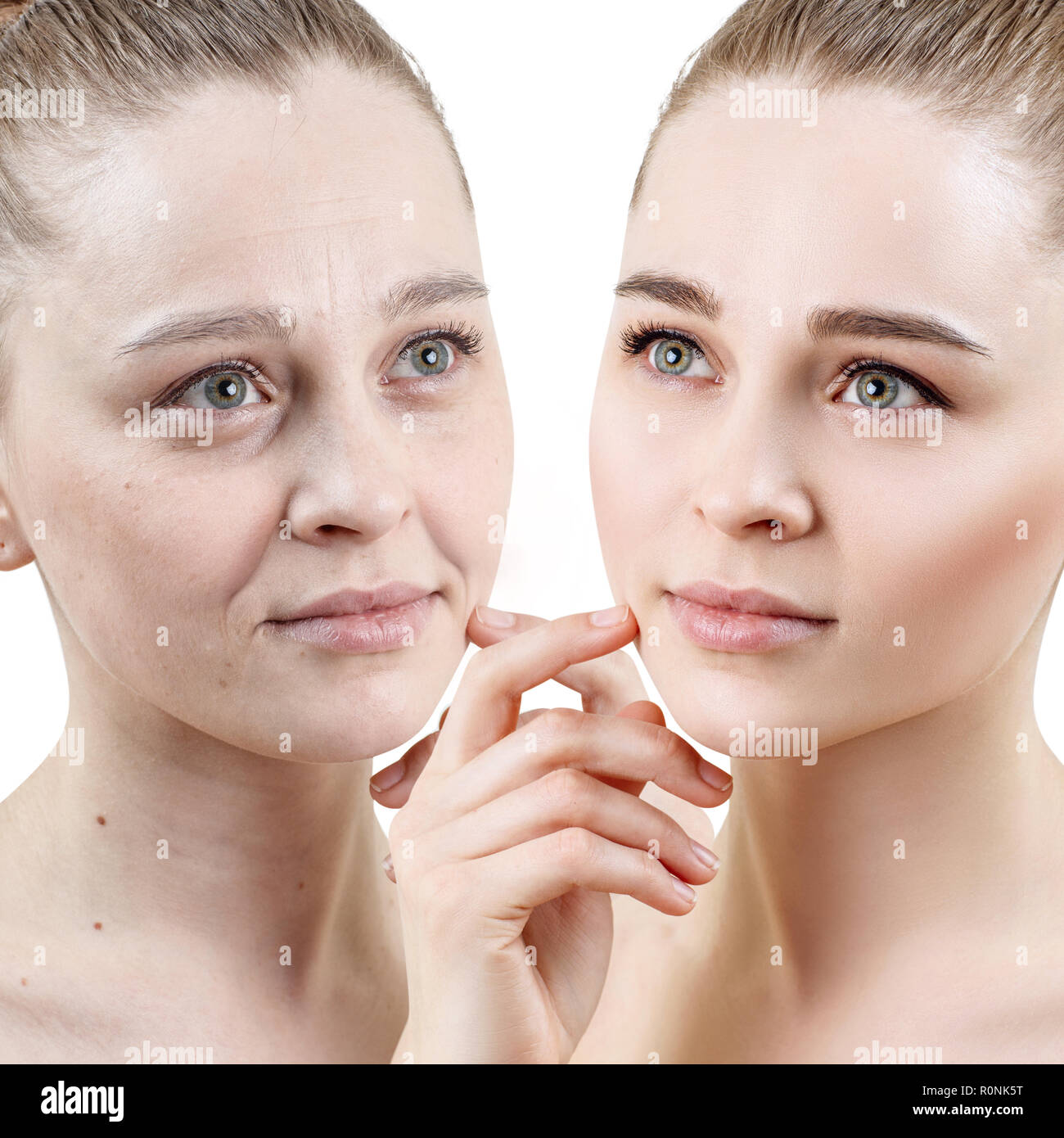Portrait von Frau vor und nach der Hautverjüngung. Stockfoto