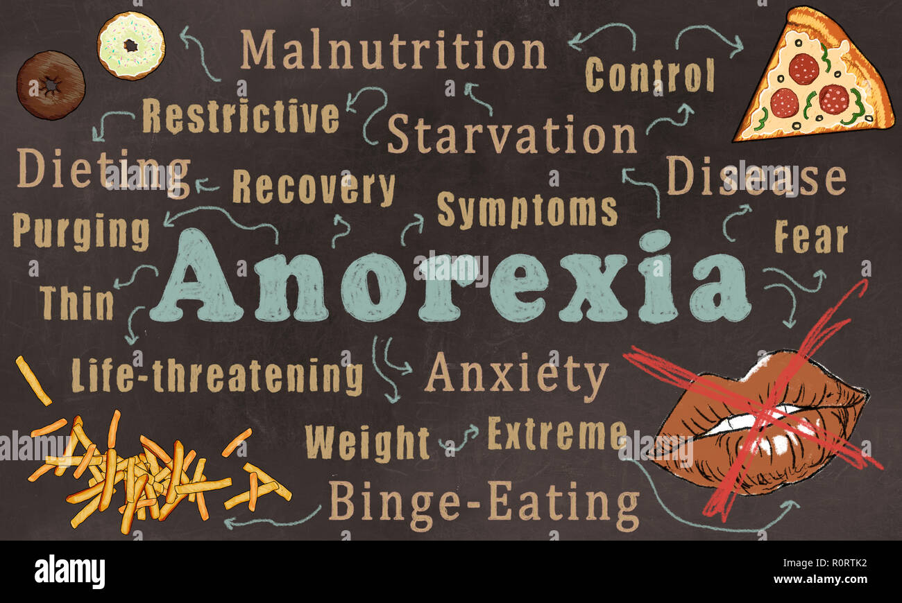 Wordcloud der Anorexia Nervosa. Dargestellt auf eine trendige Braune Tafel mit Worten, Essen und einen Mund mit einem roten Kreuz Stockfoto
